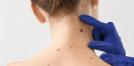 Fondasi Kulit Sehat: Perlindungan dari Faktor Eksternal